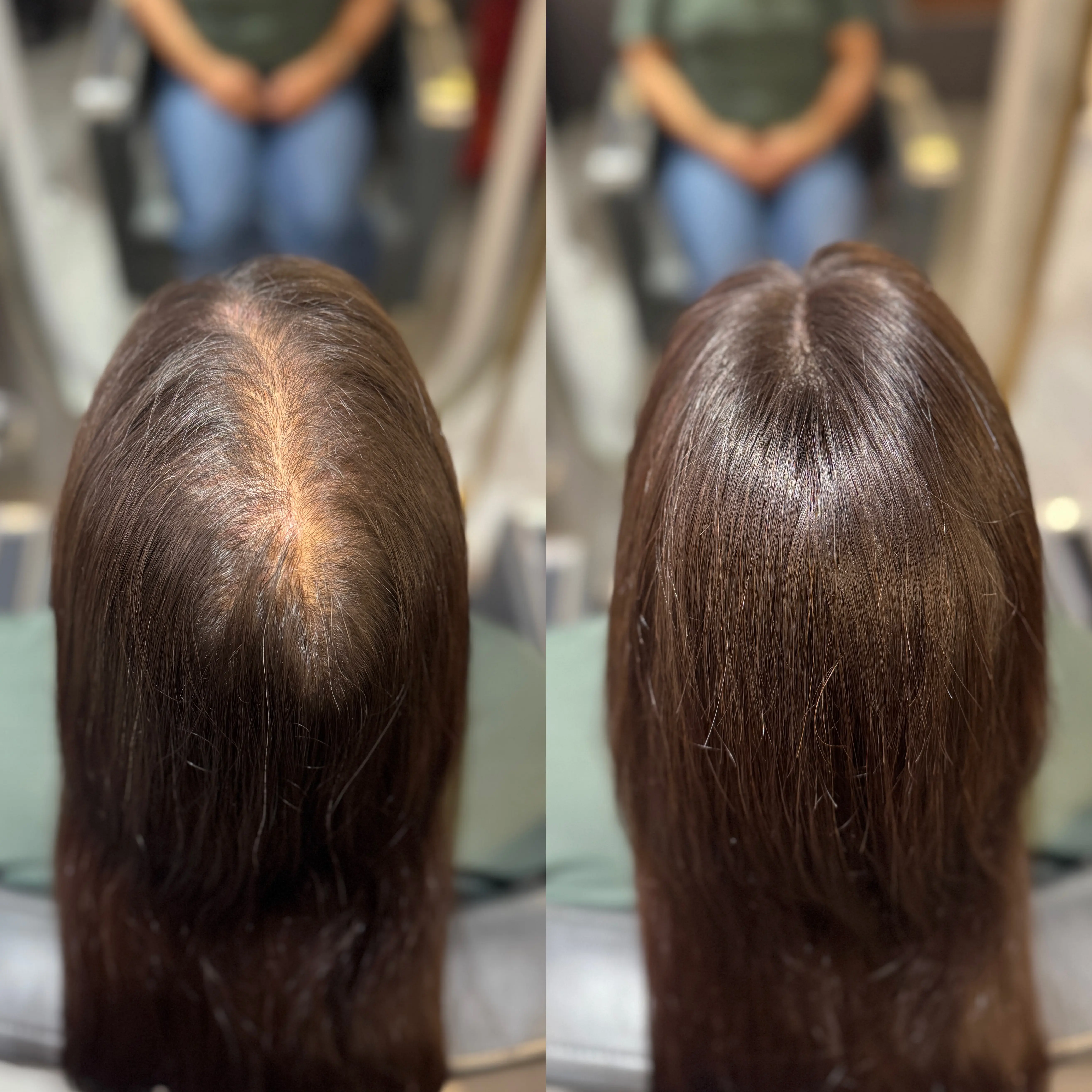 Hair Toppers