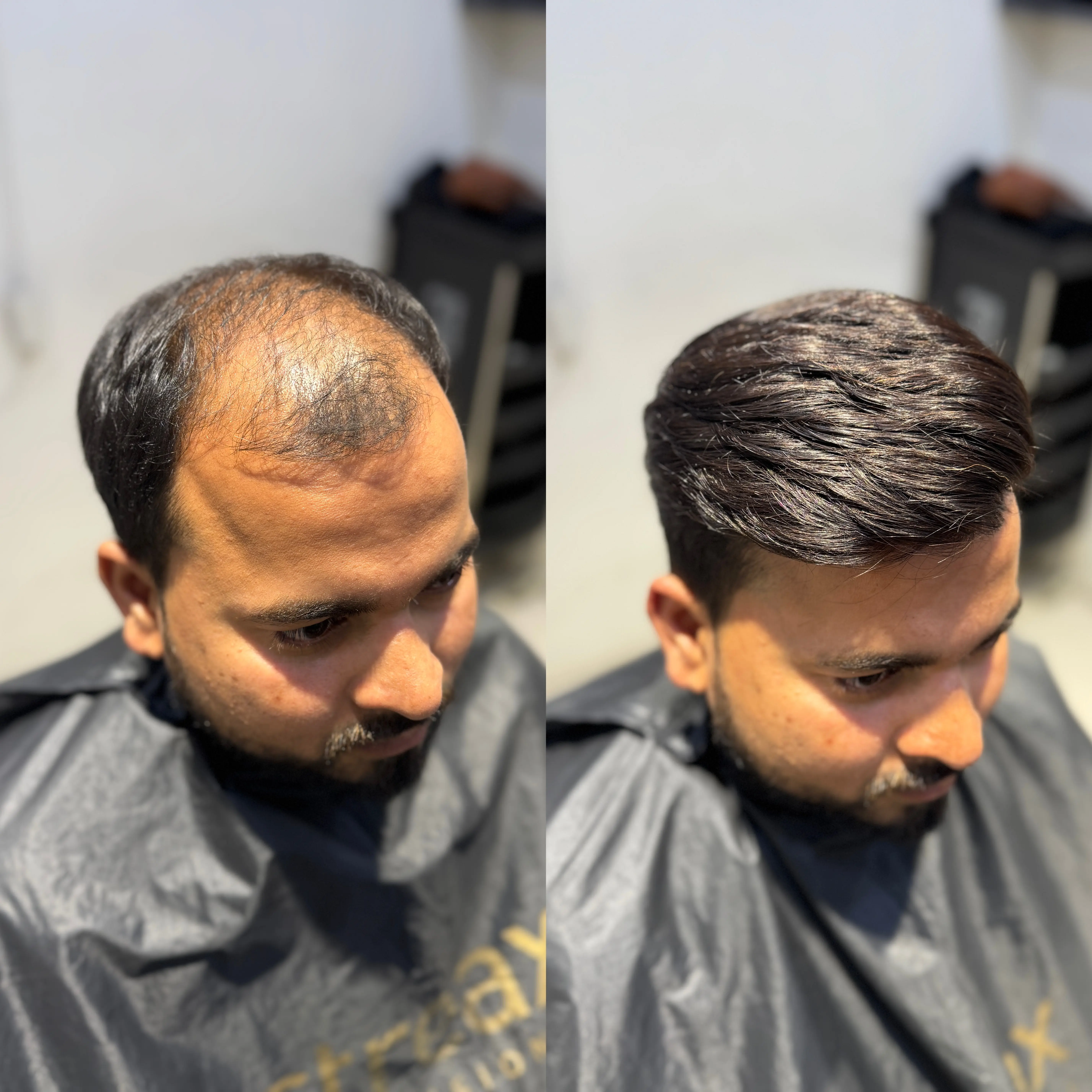 Hair Patch